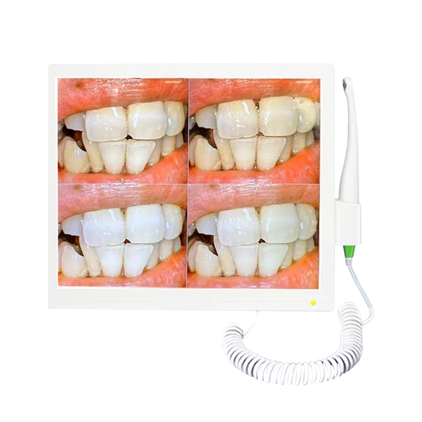 Tooth Endoscope hd Oral Dental Endoscope Equipment Nice Quality Camera hd Camera Suppliers
