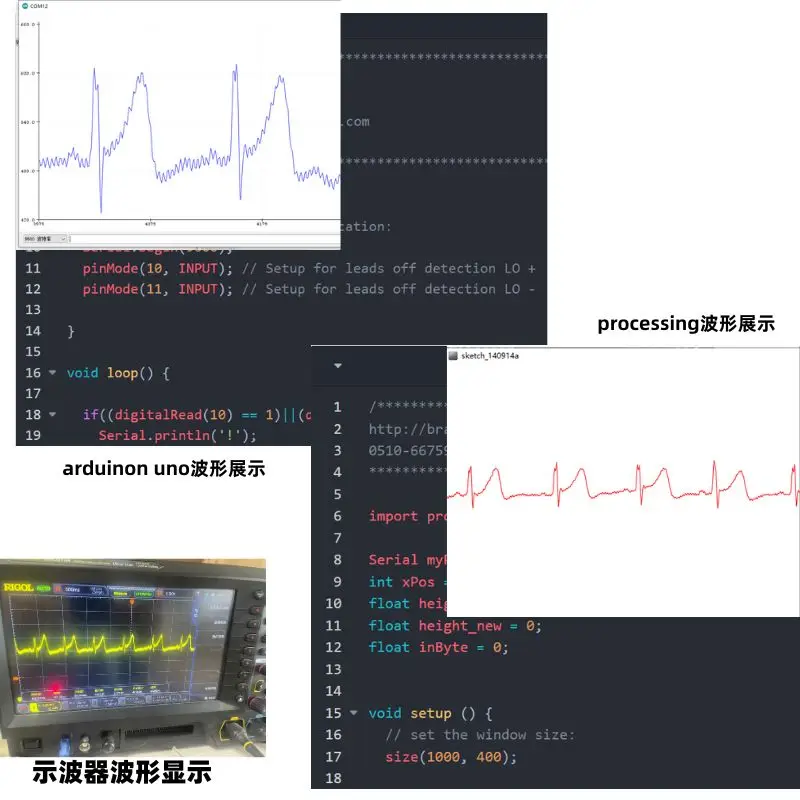 AD8232 ECG Sensor Module Pulse Heart Rate Acquisition Monitoring Analog Measurement ECG Detection Single Chip Microcomputer