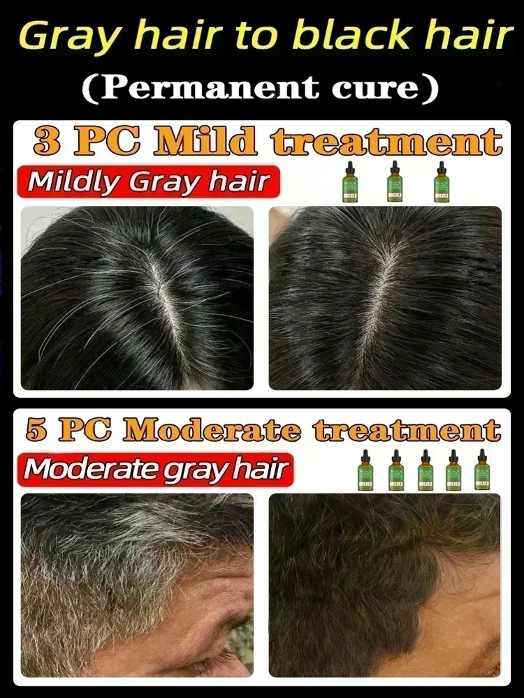 Cabello blanco a negro Natural y saludable sin color, sin alergias, Anti-gris, convierte rápidamente el cabello blanco en negro, reparaciones naturales