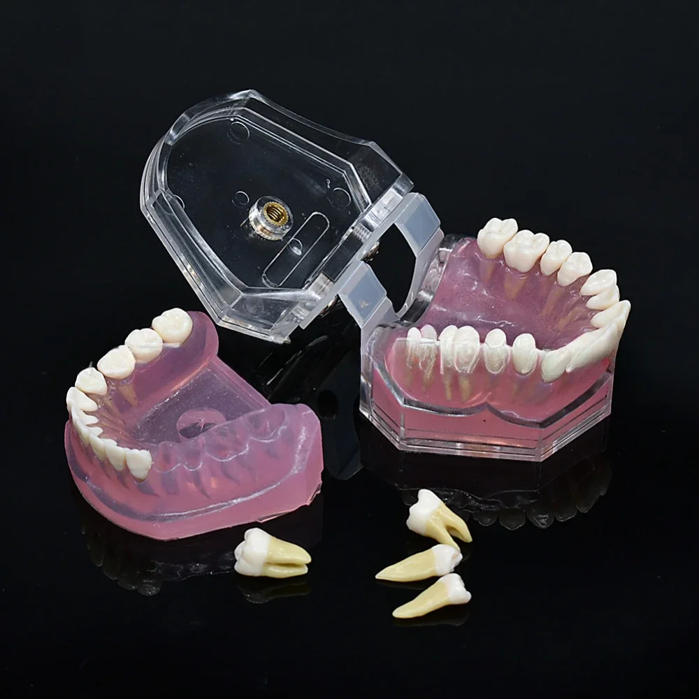 Dental Model Standard Training Technician Practice Model Soft Gum 28 Removable Teeth Adult Study Demo Teaching Dentist Equipment