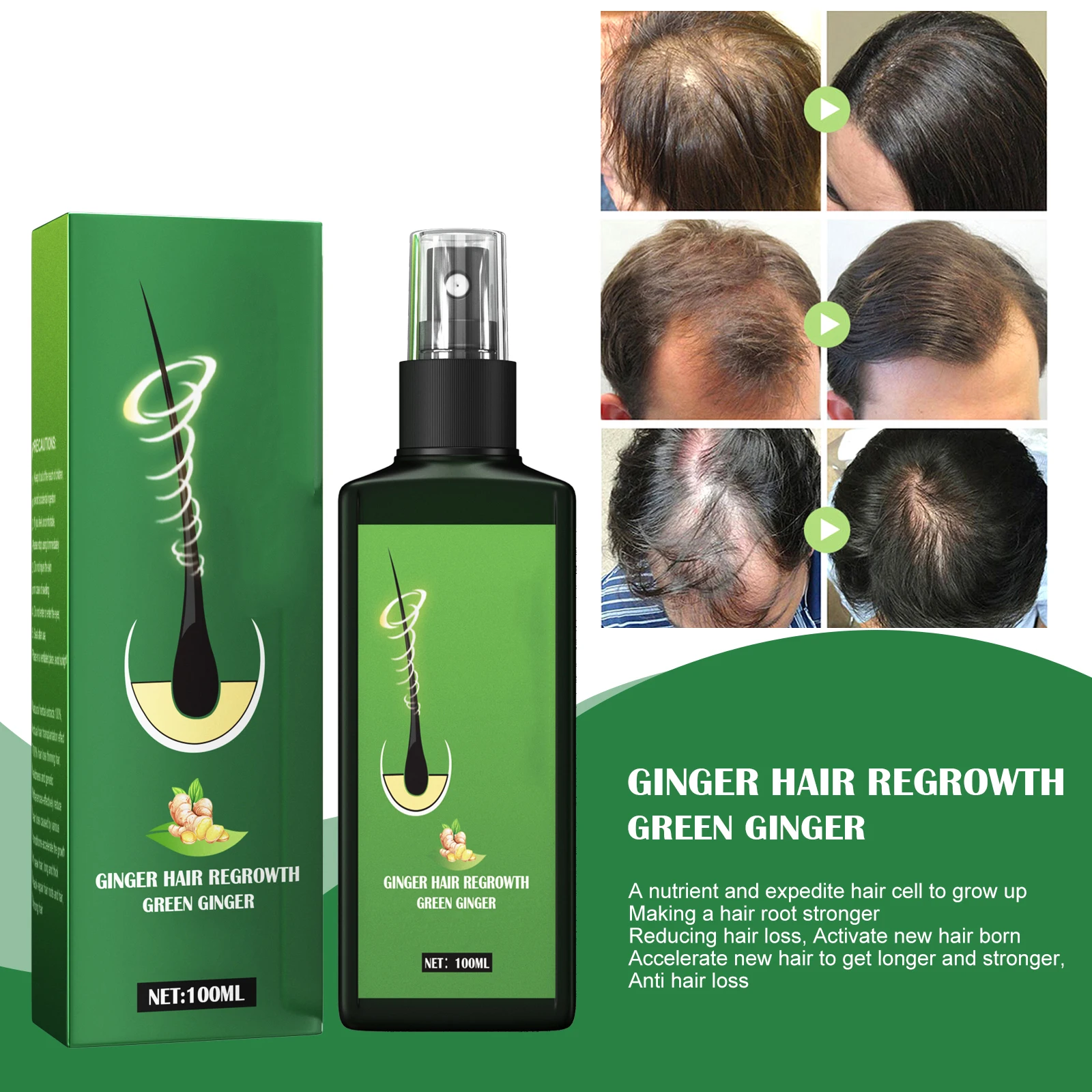 Anti Hair Loss essence Hair Growth spray Ginger Massage Scalp Damage Treatment Solution Nourishing Root Rapid Growth