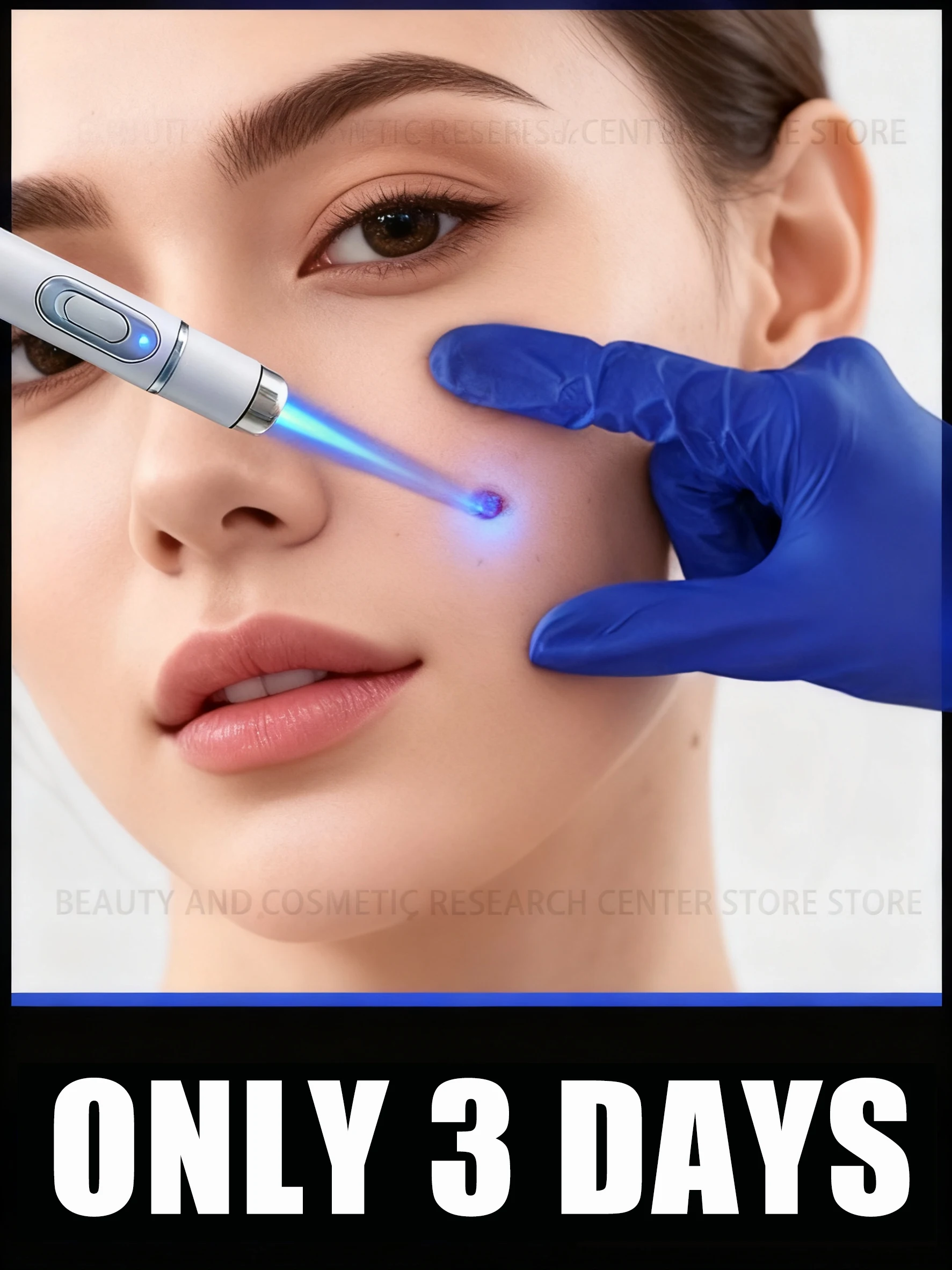 المهنية : يمنع التكرار من سبب الجذر؛ آمن وموثوق. #1