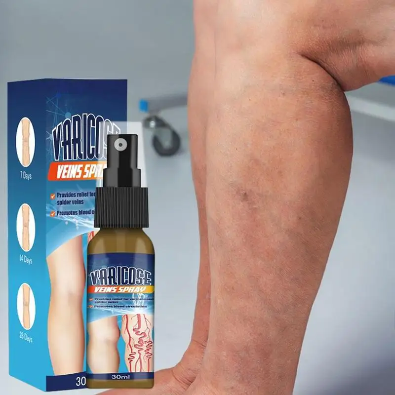 30ml Varicose Vein Smooth Spray Relief Red Blood Vessel Swelling Repair Earthworm Leg Raised Phlebitis Angiitis Mist Spray