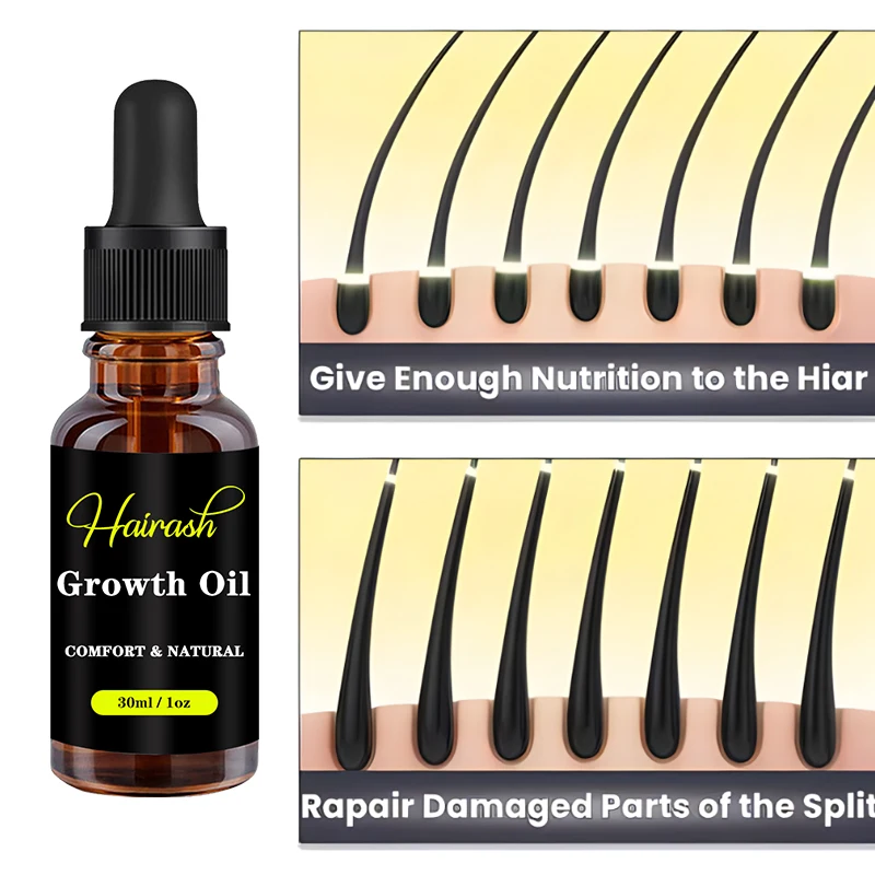 Óleo De Crescimento De Cabelo Para Homens E Mulheres, Tratamento De Perda De Cabelo, Soro De Óleo De Gengibre, Adultos