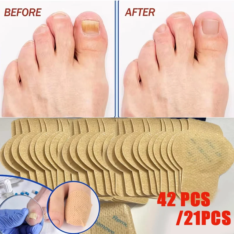 Nail Fungus Patch Waterproof Nail Repair Patch Ingrown Correction Sticker Damaged Nail Gray Care Patch Feet Care Tools