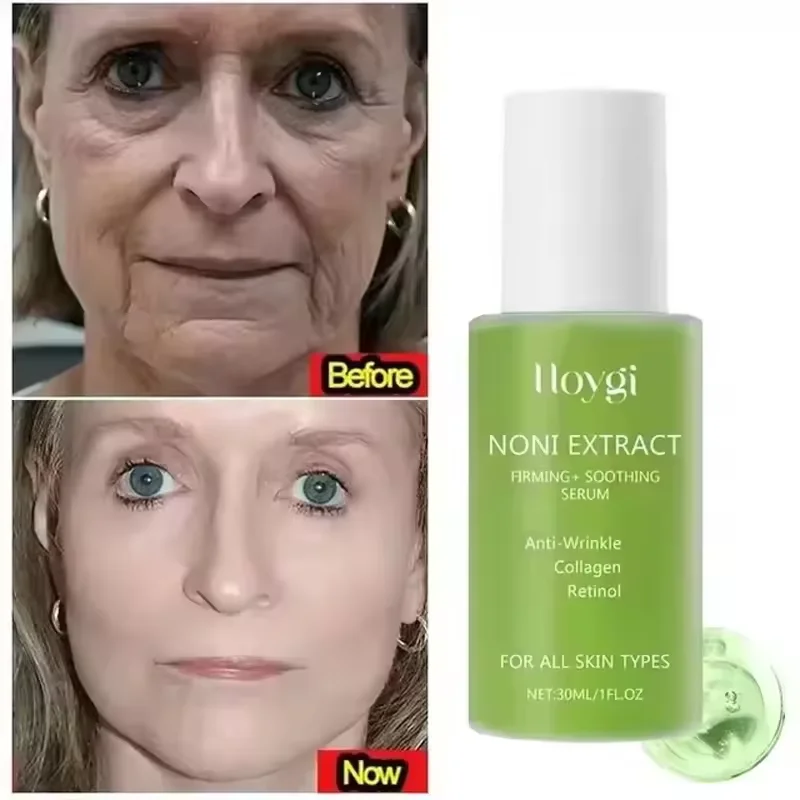 

Noni Fruit Essence Noni Extract Energy Ampoule Face Serum Korean Anti-wrinkle Moisturizing Sooth Wrinkle Fine Line Skin Care