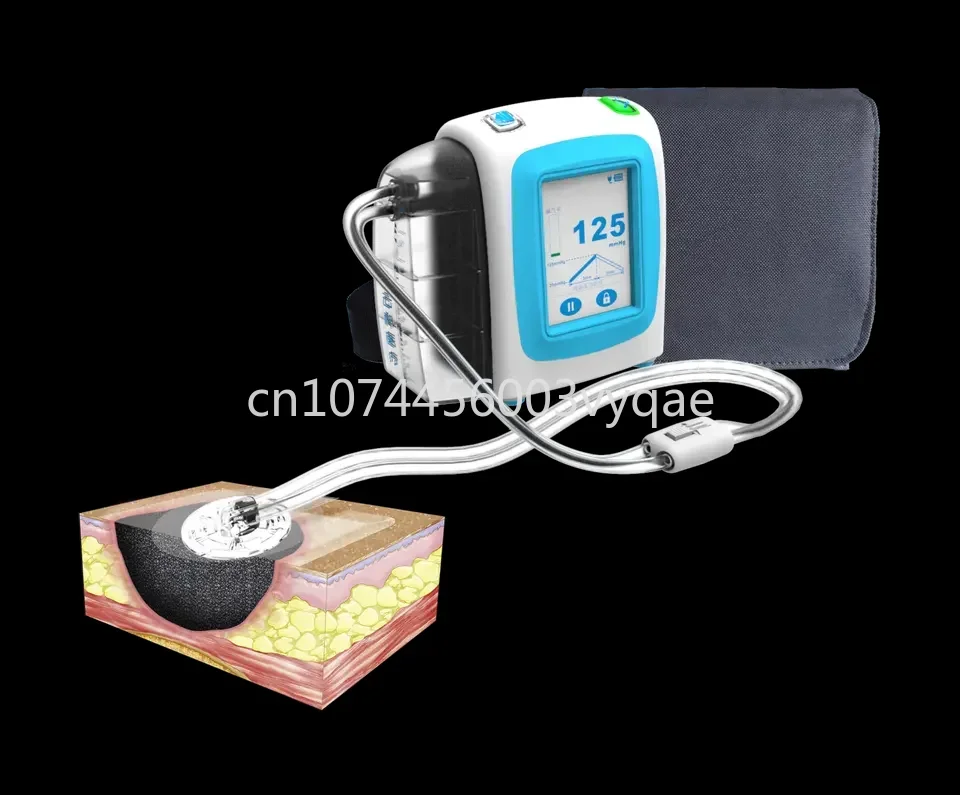 Negative pressure wound therapy machine medical device using in hospital with NPWT system kit canister450ml