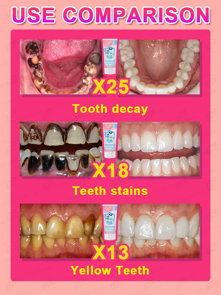 Solve tooth decay problem
