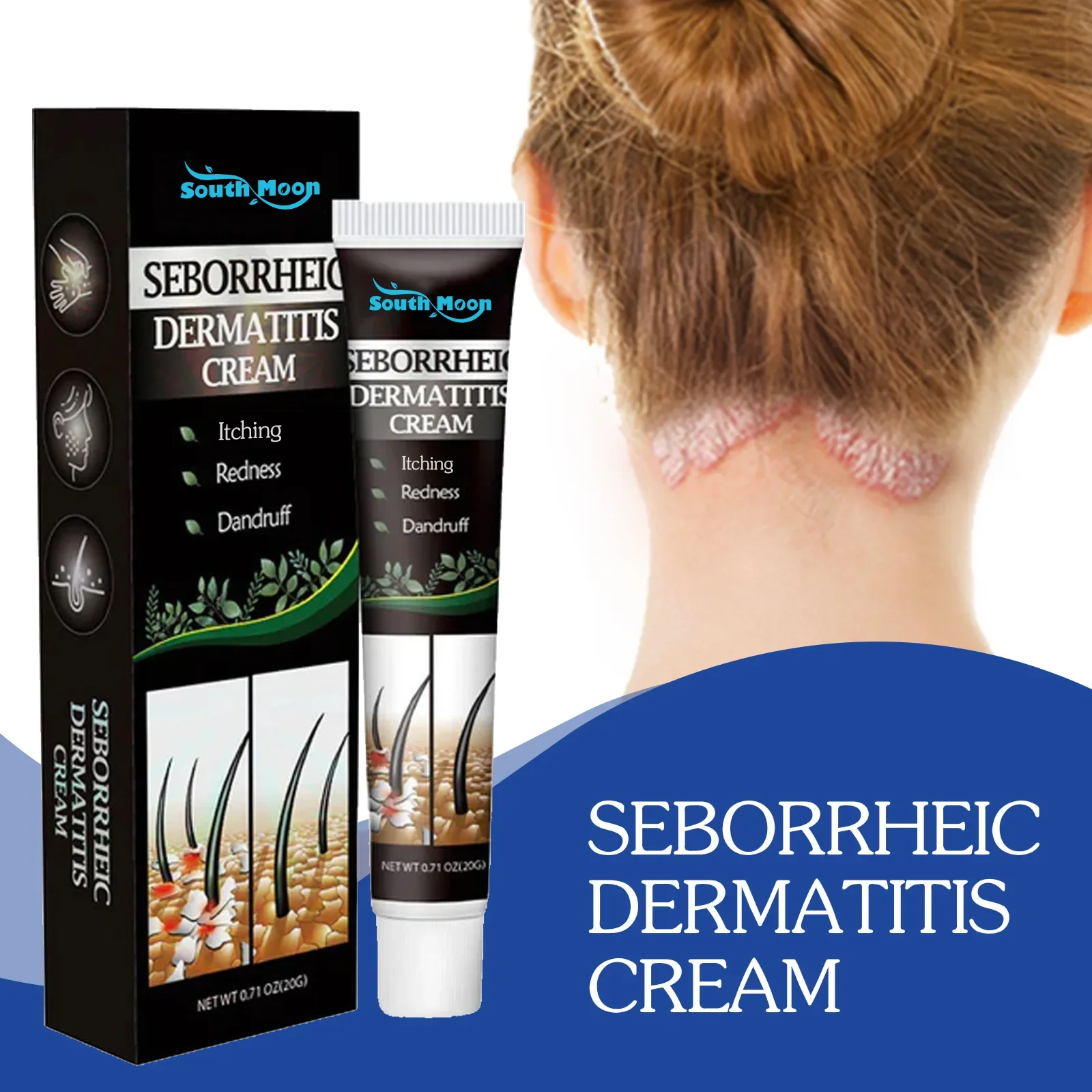 Seborrheic Skin Cream Head Acne Pruritus Scalp Ringworm Skin Problem Repair Skin Cream Cleansing Cream Hair Scalp Care