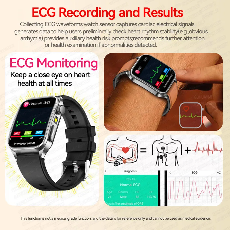 2025, neue Lasertherapie, Gesundheitspflegequalität, Harnsäure, Blutfett, EKG + PPG, Smartwatch für Männer und Frauen, Herzfrequenz, Bluetooth-Anruf-Armband