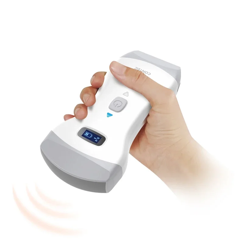 USG Scanner Medical Ultrasound Machine Portable Device