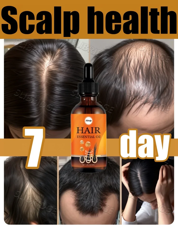 

ʜᴀɪʀ ɢʀᴏᴡᴛʜ sᴇʀᴜᴍ + ʟɪǫᴜɪᴅ ᴄᴏᴍʙ, ɪᴍᴘʀᴏᴠᴇs ᴛʜɪɴɴɪɴɢ sᴄᴀʟᴘ ɪɴ 7 ᴅᴀʏs