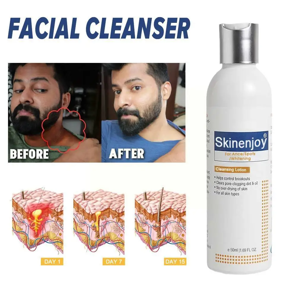 

Отбеливающее очищающее средство для лица Skinenjoy, осветляет тон кожи, отбеливает, выцветает, гладкая пена, освежающее удаление лица, хлоазма C9S2