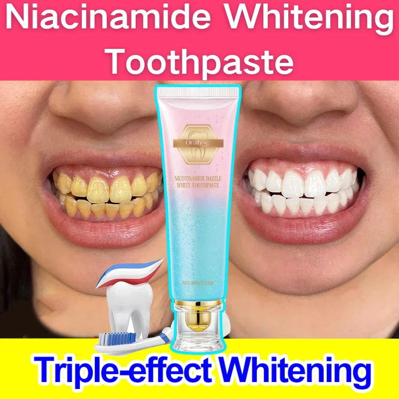 

Niacinamide Whitening Toothpaste Reduce Plaque Fresh Bad Breath Stains Removing Hygiene Clean Dazzling Brighten Oral Teeth Care