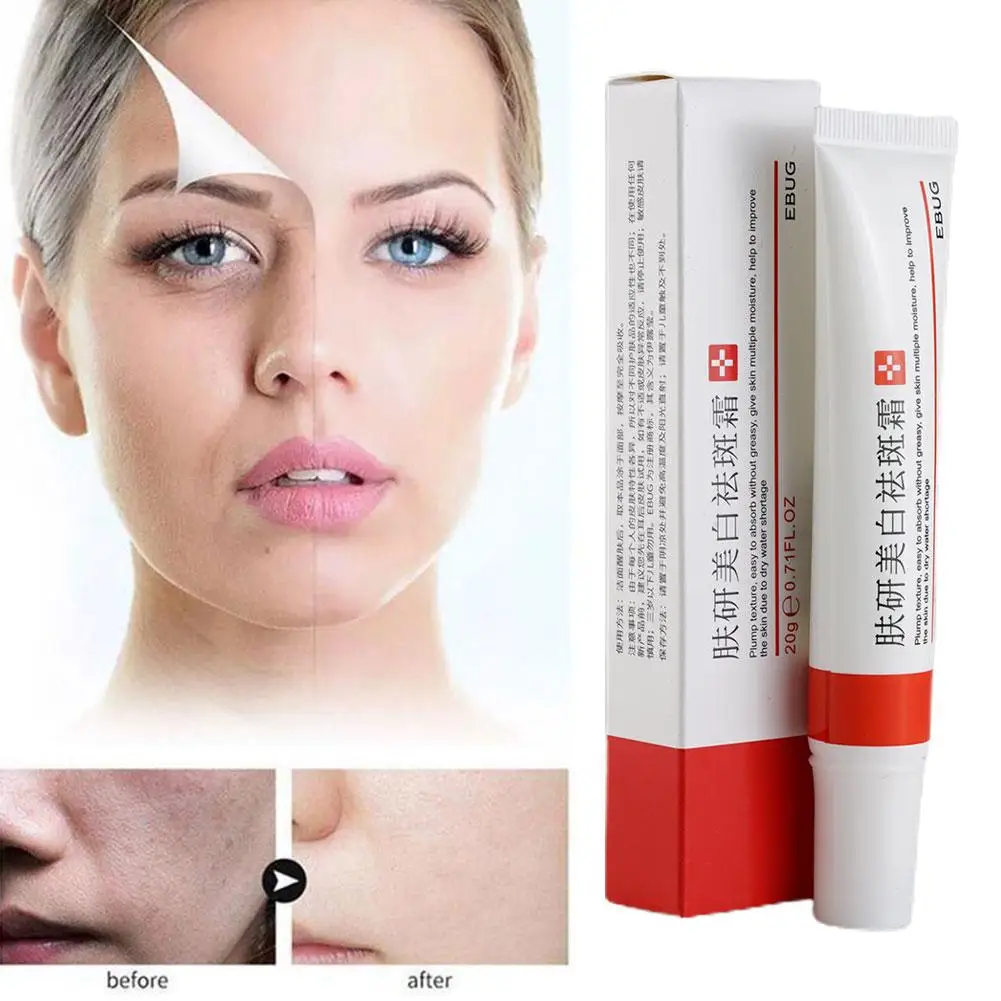 

Effective Whitening Freckle Cream Remove Dark Spots Anti Freckle Cream Niacinamide Fade Pigmentation Melasma Brighten Creams