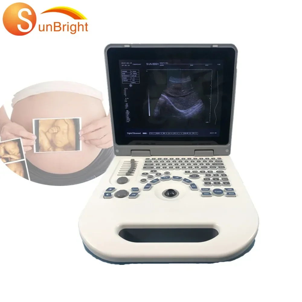 

Cheapest price Sunbright portable ultrasound 2D medical diagnostic ultrasound machine