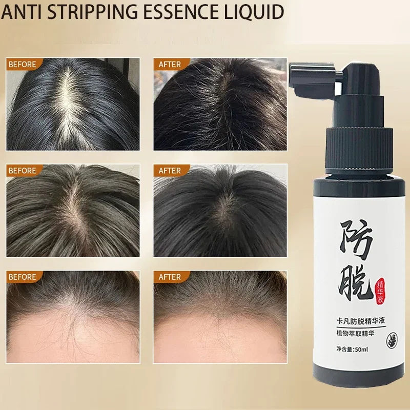 Anti stripping essence spray Polygonum multiflorum Thunb lateral cypress leaf scalp nutrient solution herbal plant hair firming