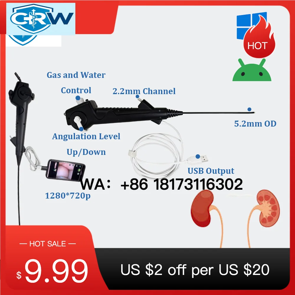 CRW USB HD Cystoscope Flexible   Digital   Urology Videoscope Factory Price Cystoscope for Vet
