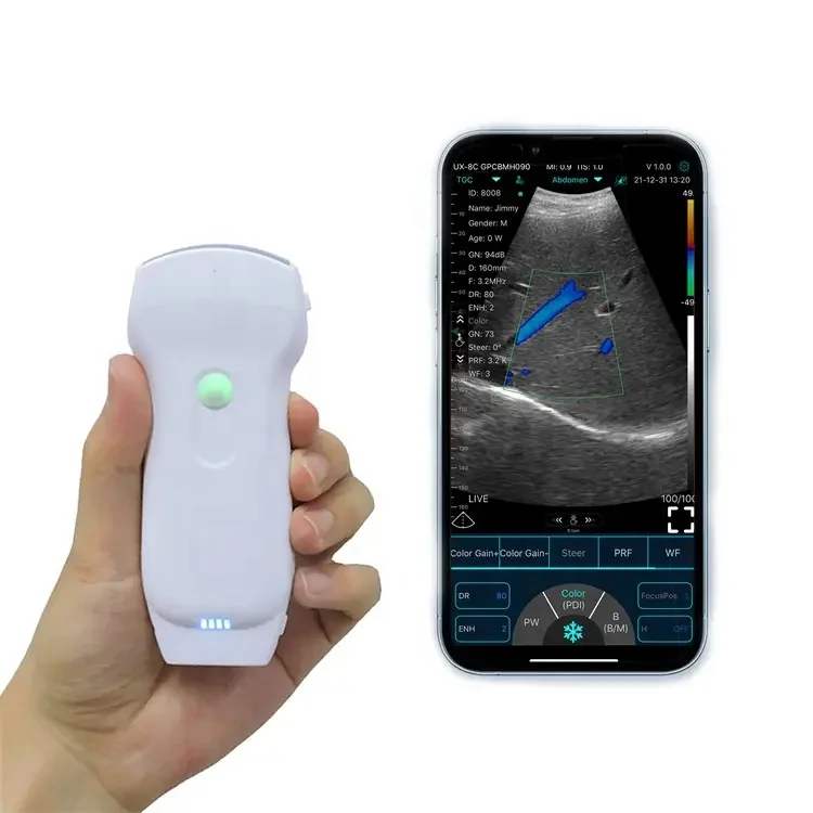 3 in 1 Convex&Phased+Linear/Transvaginal Wireless USG Medical Cardiac Examination Portable Ultrasound Doppler Ultrasound Scanner
