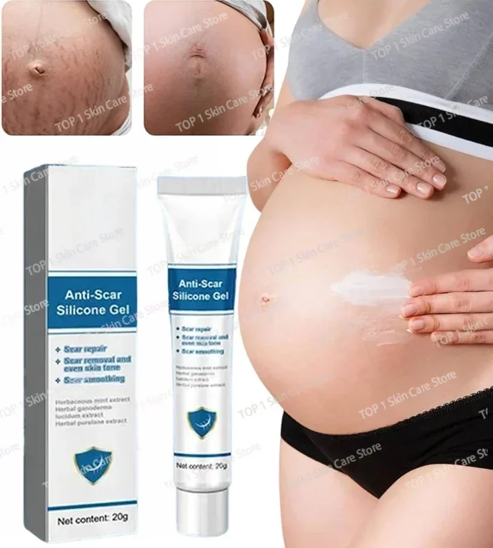 

Remove stretch marks during pregnancy and quickly remove scars