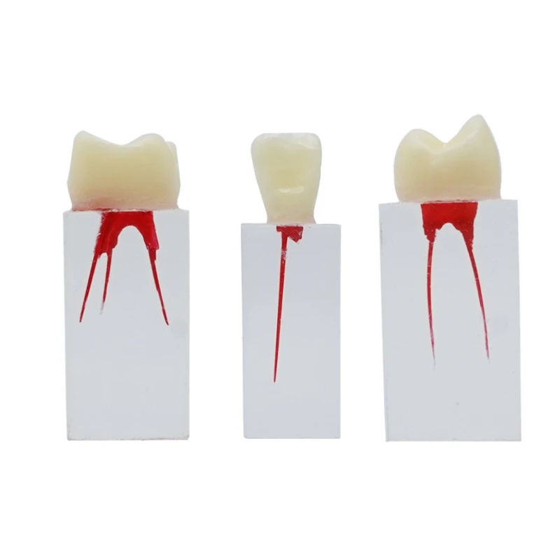 3Pcs Dental Endodontic Root Canal Blocks Endo Pulp Cavity RCT Practice Model Treatment Training Tooth Model