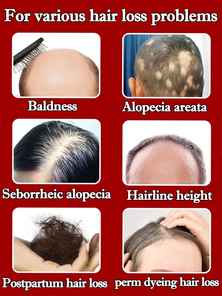 

The secret of thicker hair