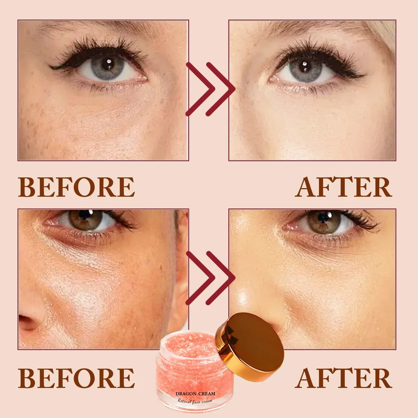 كريم الريتينول المضاد للتجاعيد - تركيبة ماركة Dragon مع HA. يحدث لون البشرة ويقلل الخطوط الدقيقة. علاج الترطيب. #3