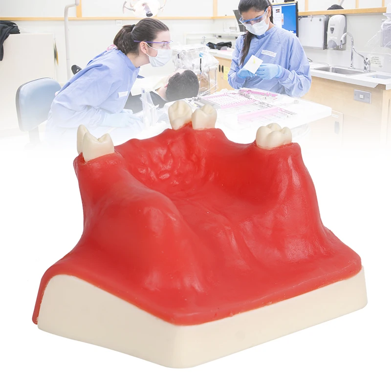 1pc Maxillary Sinus Teeth Model Upper Jaw Restoration Dental Implant Teaching Model Dentist Student Practice Studying Oral Model
