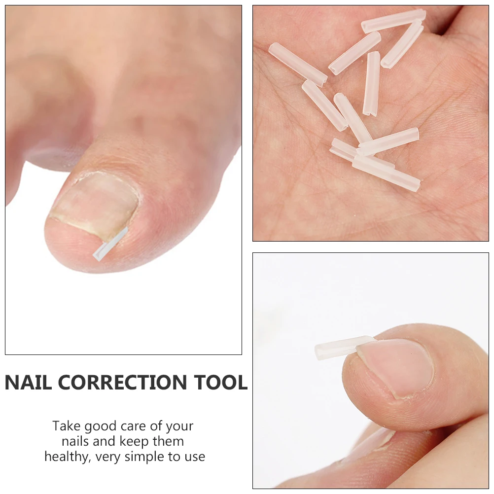 

Ingrown Toe Nail Corrector Pedicure Tools Paronychia Care Accessory Liner Healthy Stainless Steel Fine Material Safe Nail