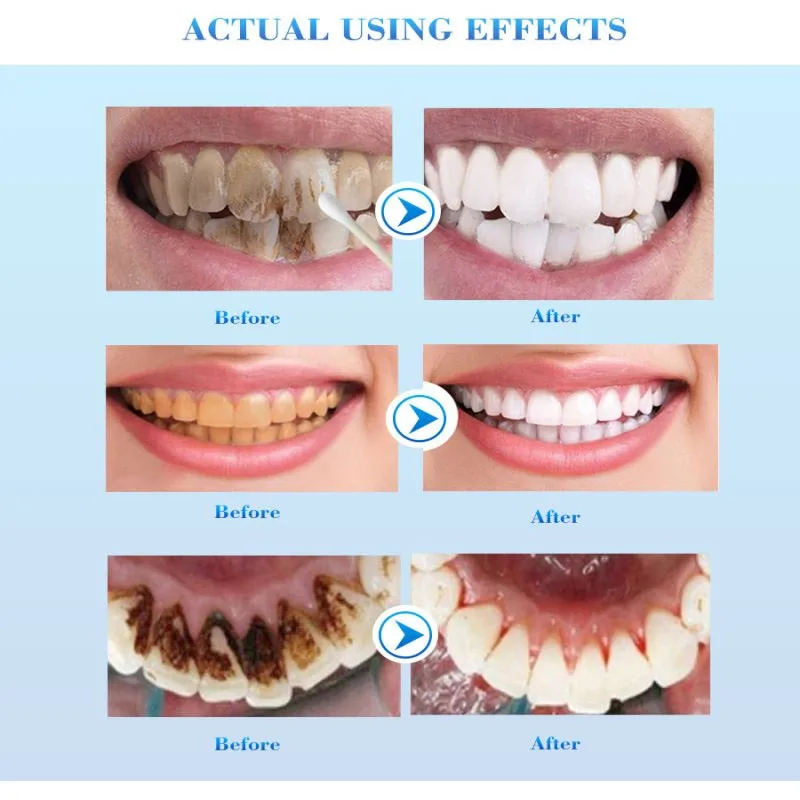 Whitening Tooth Toothpaste Freshen Breath Remove Smoke Stains Oral Hygiene Clean Effectively Removal Yellow Teeth Dental Care