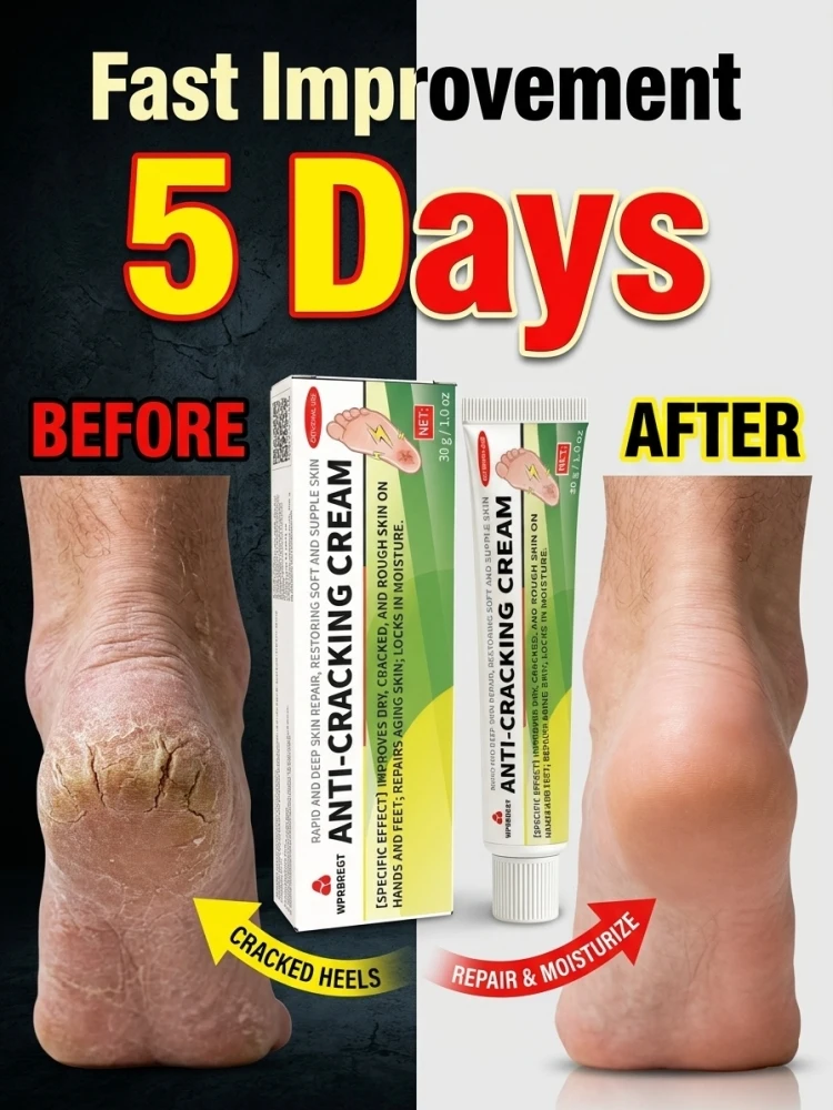 Hand Foot Dry Skin Care Balm, Deep Hydrating Moisturizer, Lock Skin Moisture, Soften Rough Cuticles, Fast Penetrating Cream for Multi-Part Dry Skin
