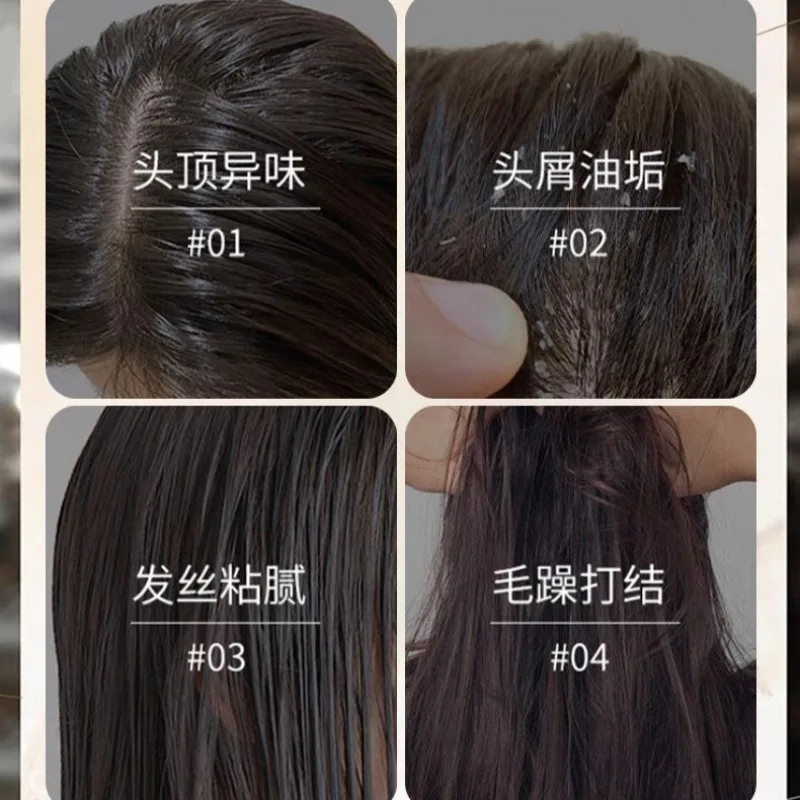 200ml Sulfur ANTI DANDRUFF Balancing Shampoo Scalp Purifying Flake Control Oil Regulation, Hydrating Frizz-Free Smoothness