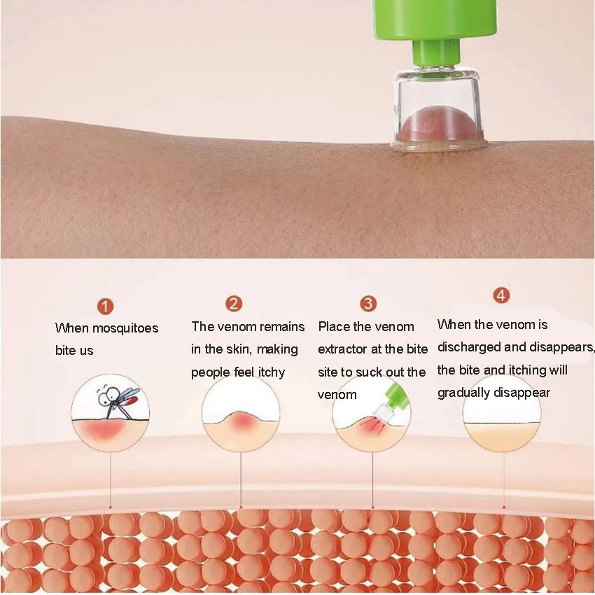 Tratamento de emergência para picadas de insetos Vácuo Extrator de veneno de pressão negativa Extrator de veneno