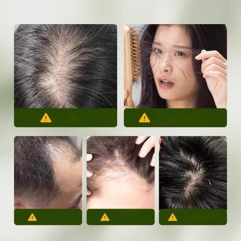 Sabun Buatan Tangan Polygonum Multiflorum, Batang Sampo Rumput Usman 120g