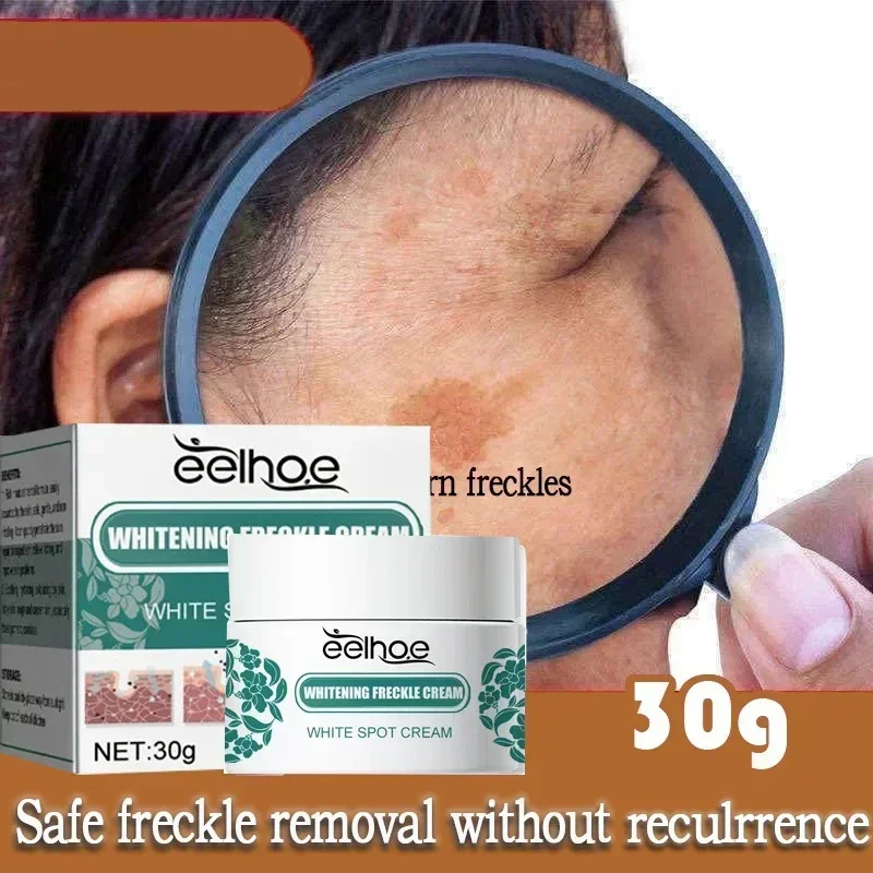 Removal Dark Spots Whitening Freckle Cream Brightening Cream Reduce Melanin Brighten Cream Lighten Dark Skin Chloasma Serum