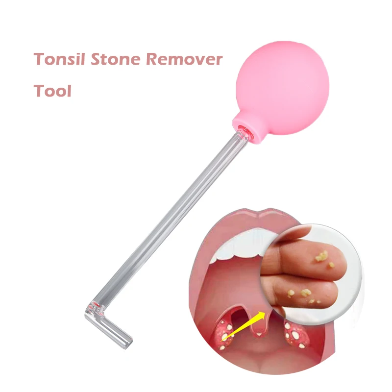 

1pc Random Color Tonsil Stone Remover Tool PVC Suction Ball Manual Mouth Cleaning Care Freshen Breath Oral Hygiene Cleaner