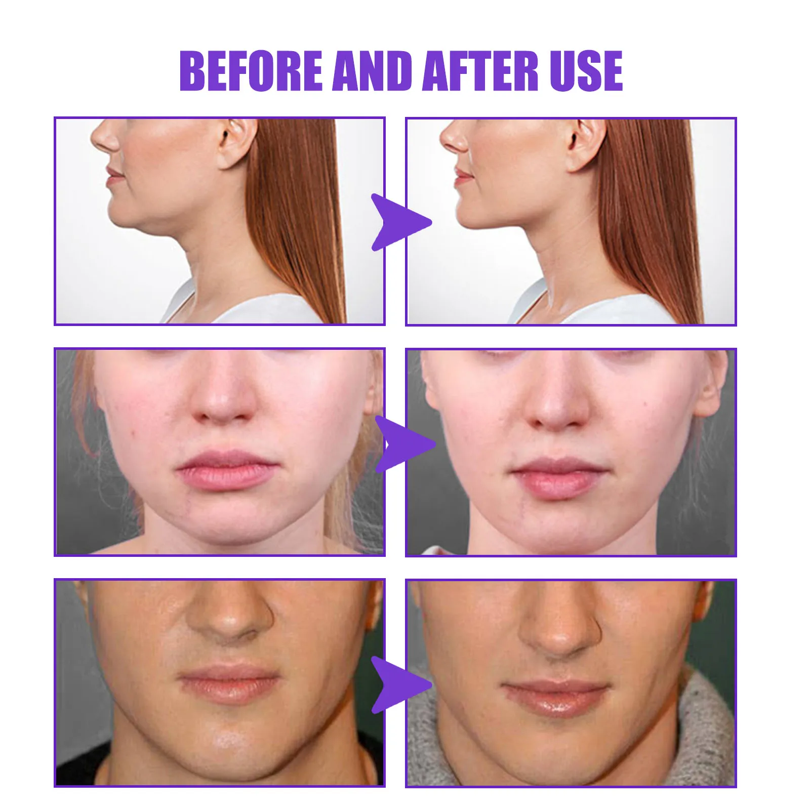 V-Shape Slimming Cream Tighten Mandibular Line Double Chin Lift Firming Face Fat Burning Massage V Face Cream Facial Skin Care