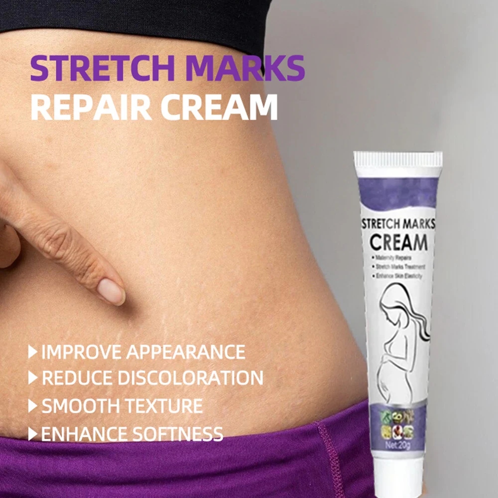 

Stretch Mark Repair Cream For Pregnant Women Postpartum Care Firm Light Lines Obesity Lines Growth Lines Repair Cream