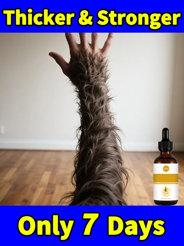 

No one have bald head