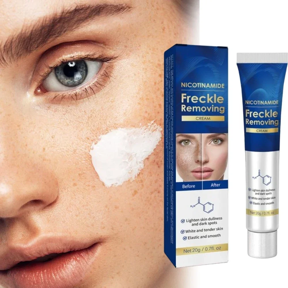 Effizienter Entferner für dunkle Flecken zur Gesichts entfernung Sommersprossen Melasma Chloasma senile Plaques Sonnenbrand Cyasma Chorio plaque Sommersprossen creme