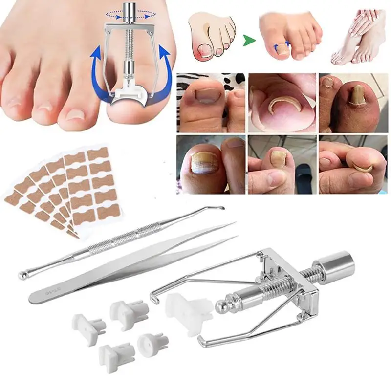 1 Set Adhesive Toenail Patch Ingrown Toe Nail Correction Sticker Foot Corrector Pedicure Healthcare Tools Toe Treatment Pad