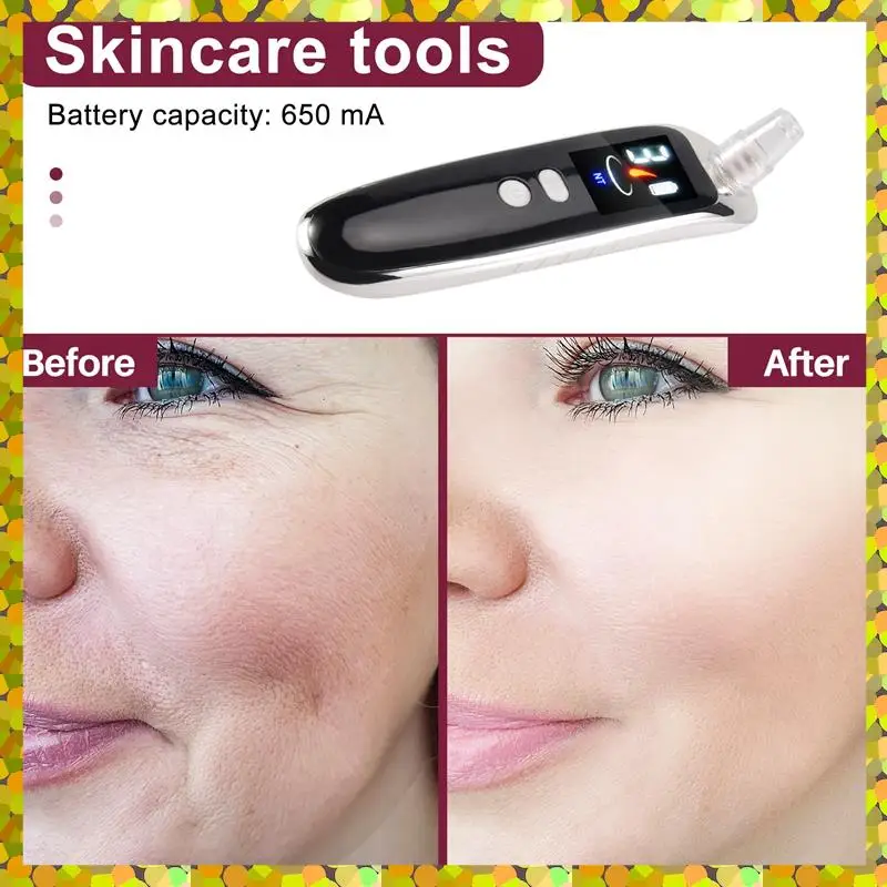 AGLH Face Nose Acne Black Dot Pimple Blackhead Remover Electric Blackhead Vacuum Cleaner Pore Skin Care Tools Machine With 6 Hea