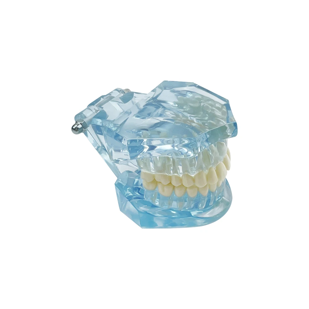 1 Pack Dental Normal Tooth Model With Clear Tooth Structure 1:1 Model Suitable For Teeth Model For Studying Education Display