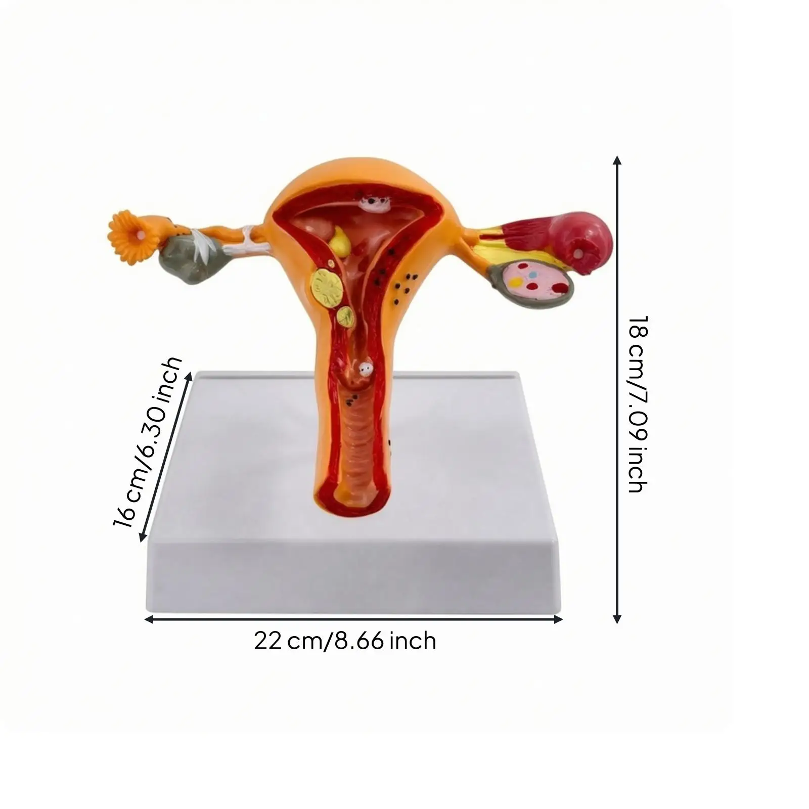 Uterus Anatomy Model Plastic Female Reproductive System Teaching Aid for Medical Training