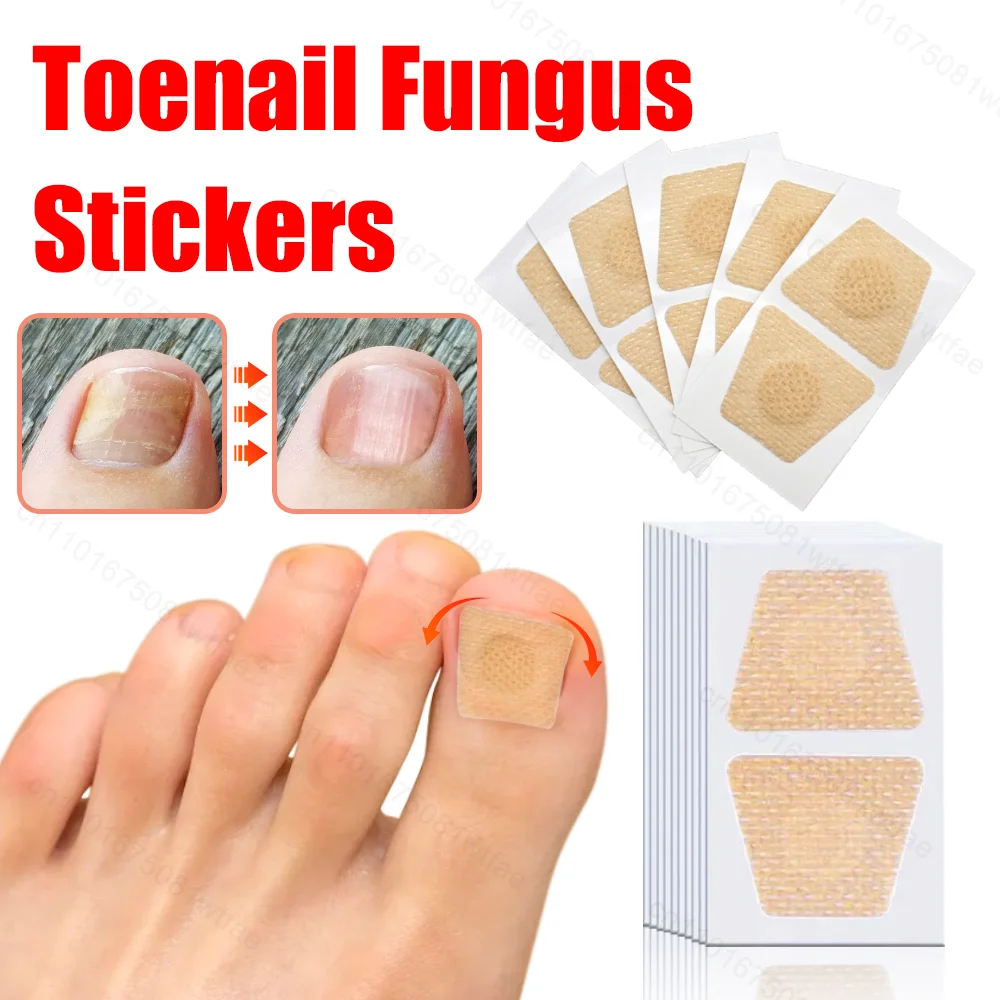 Nail Repair Patches Breathable Paronychia Nail Treatment Stickers Waterproof Sticky Ingrown Toenail Corrector Fungus Patch