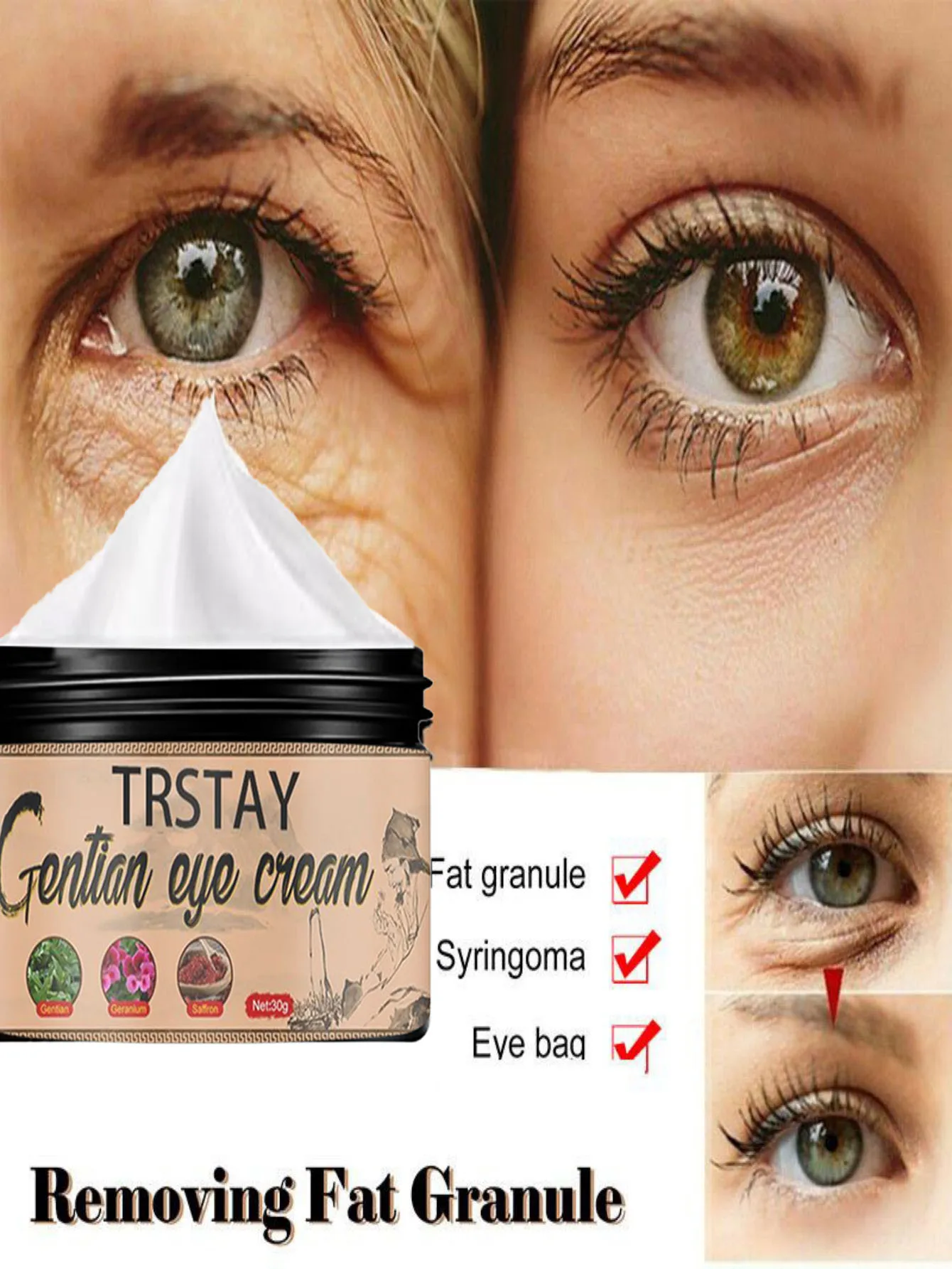 Effective Anti-Wrinkle Whitening Cream Anti-aging Face Cream Eye Serum Remove Fat Granule Dark Circles Skin Care