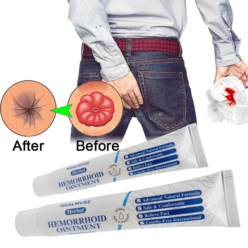 Chinese Medical Herbal Hemorroidas Pomada, Creme antibacteriano para Pilhas Internas, Fissura Anal Pomada Alívio da Dor, 20g