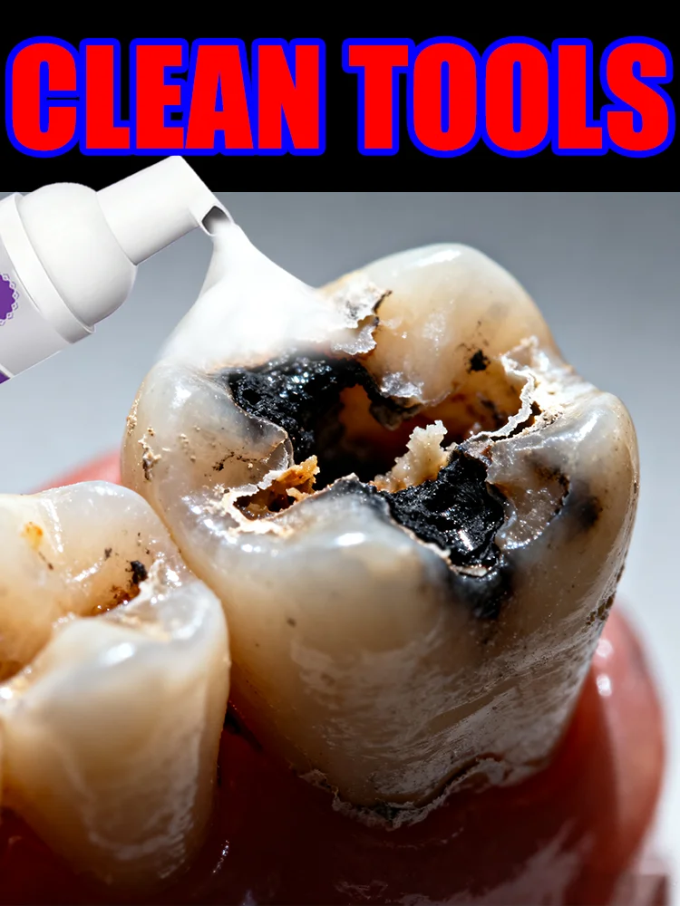 A mousse to lick, a shield unseen.,Inventory shortage,Intraoral Mousse clean tools