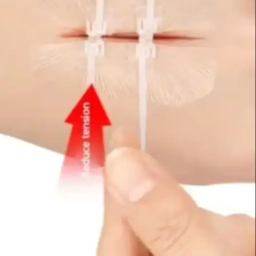 

Пластырь на молнии, безболезненное устройство для закрытия ран, пластыри для перевязки на рану без швов, пластырь для уменьшения швов на молнии, пластырь