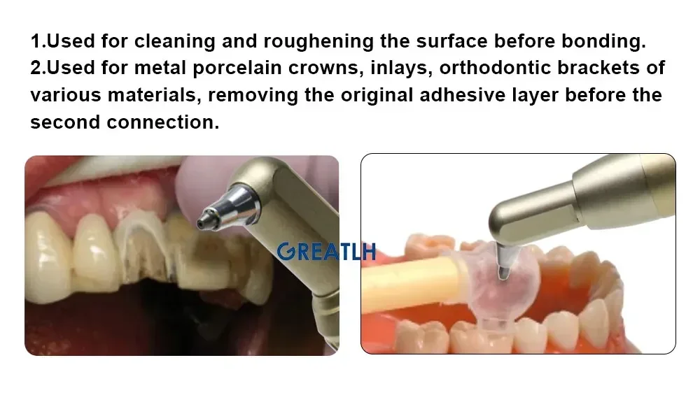 Aluminums sandblastings machines Dentals Air Polishers aluminums Oxides Air Abrasions master Sandblasters Devices